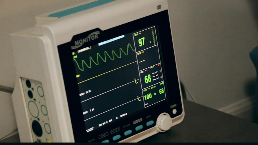 ECG monitor